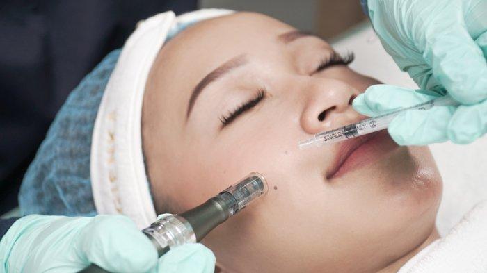 Microneedling with salmon DNA