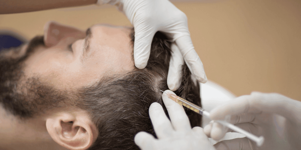 Hair Restoration