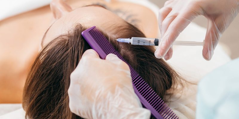 PDGF hair restoration