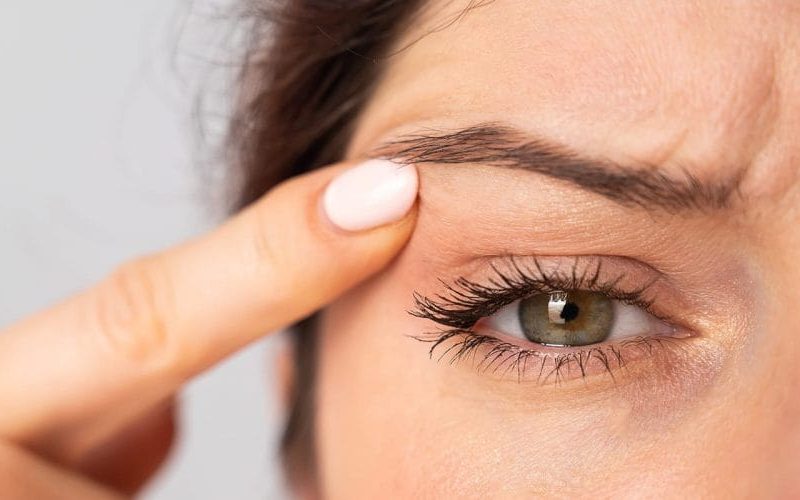 botox chicago botox chicago