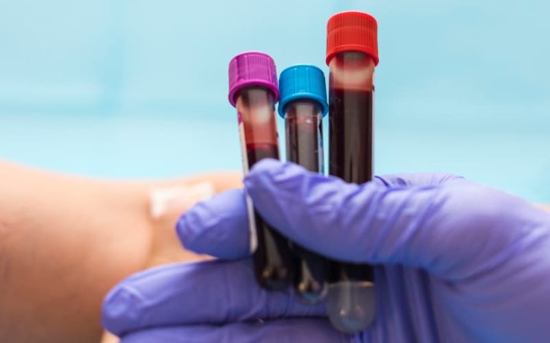 nurse holding blood test vials in gloved hand